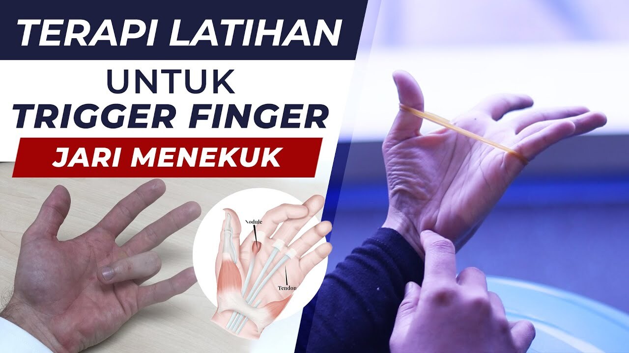 7 Terapi Latihan Untuk TRIGGER FINGER - Fisioterapi First Physio - YouTube